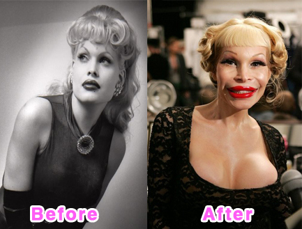 plastic-surgery-disasters-1